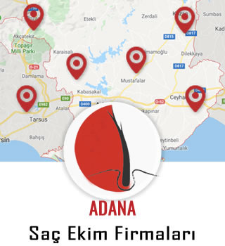 Adana Saç Ekim Firmaları
