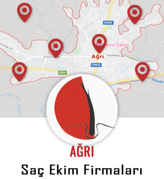 Ağrı Saç Ekim Firmaları