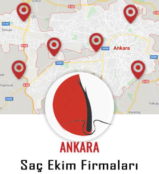 Ankara Saç Ekim Firmaları