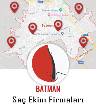 Batman Saç Ekim Firmaları