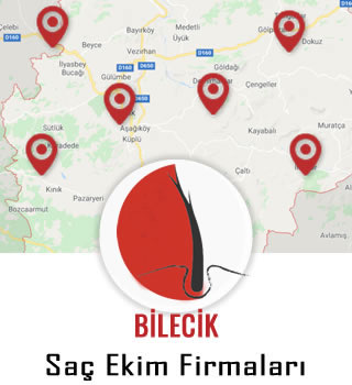 Bilecik Saç Ekim Firmaları