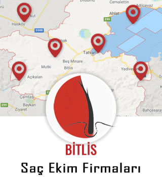 Bitlis Saç Ekim Firmaları