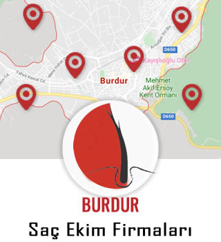 Burdur Saç Ekim Firmaları