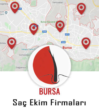 Bursa Saç Ekim Firmaları