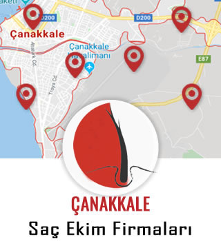 Çanakkale Saç Ekim Firmaları