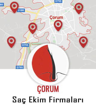 Çorum Saç Ekim Firmaları