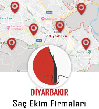 Diyarbakır Saç Ekim Firmaları