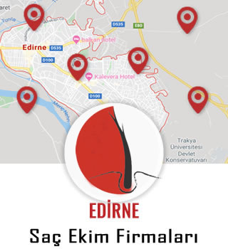 Edirne Saç Ekim Firmaları