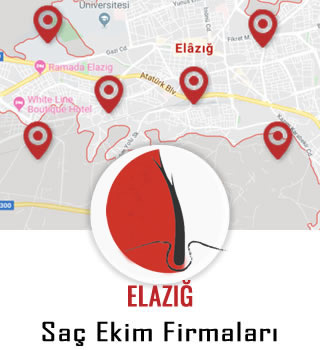 Elazığ Saç Ekim Firmaları