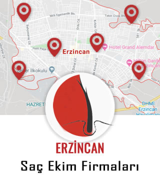 Erzincan Saç Ekim Firmaları