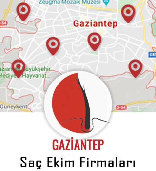 Gaziantep Saç Ekim Firmaları