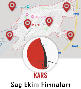 Kars Saç Ekim Firmaları