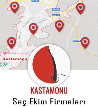 Kastamonu Saç Ekim Firmaları