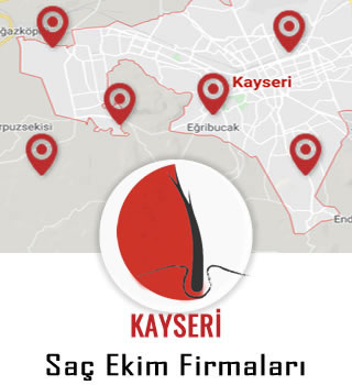Kayseri Saç Ekim Firmaları