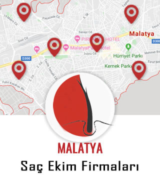 Malatya Saç Ekim Firmaları