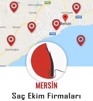 Mersin Saç Ekim Firmaları