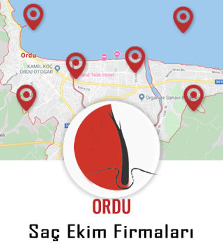 Ordu Saç Ekim Firmaları