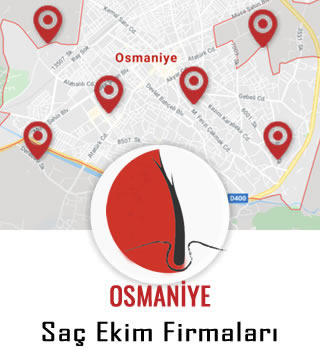 Osmaniye Saç Ekim Firmaları