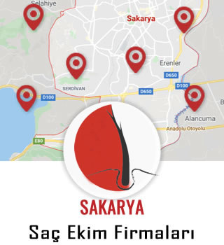 Sakarya Saç Ekim Firmaları