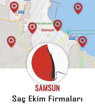 Samsun Saç Ekim Firmaları