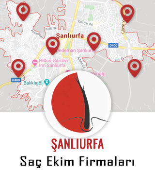Şanlıurfa Saç Ekim Firmaları