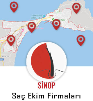 Sinop Saç Ekim Firmaları