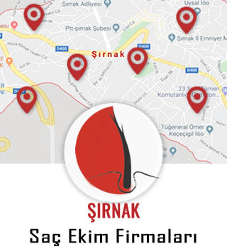 Şırnak Saç Ekim Firmaları