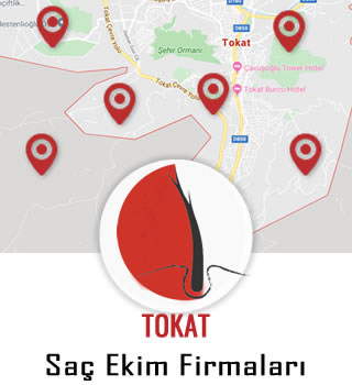 Tokat Saç Ekim Firmaları