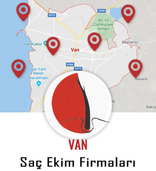 Van Saç Ekim Firmaları