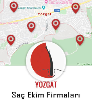 Yozgat Saç Ekim Firmaları