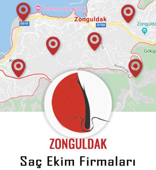 Zonguldak Saç Ekim Firmaları